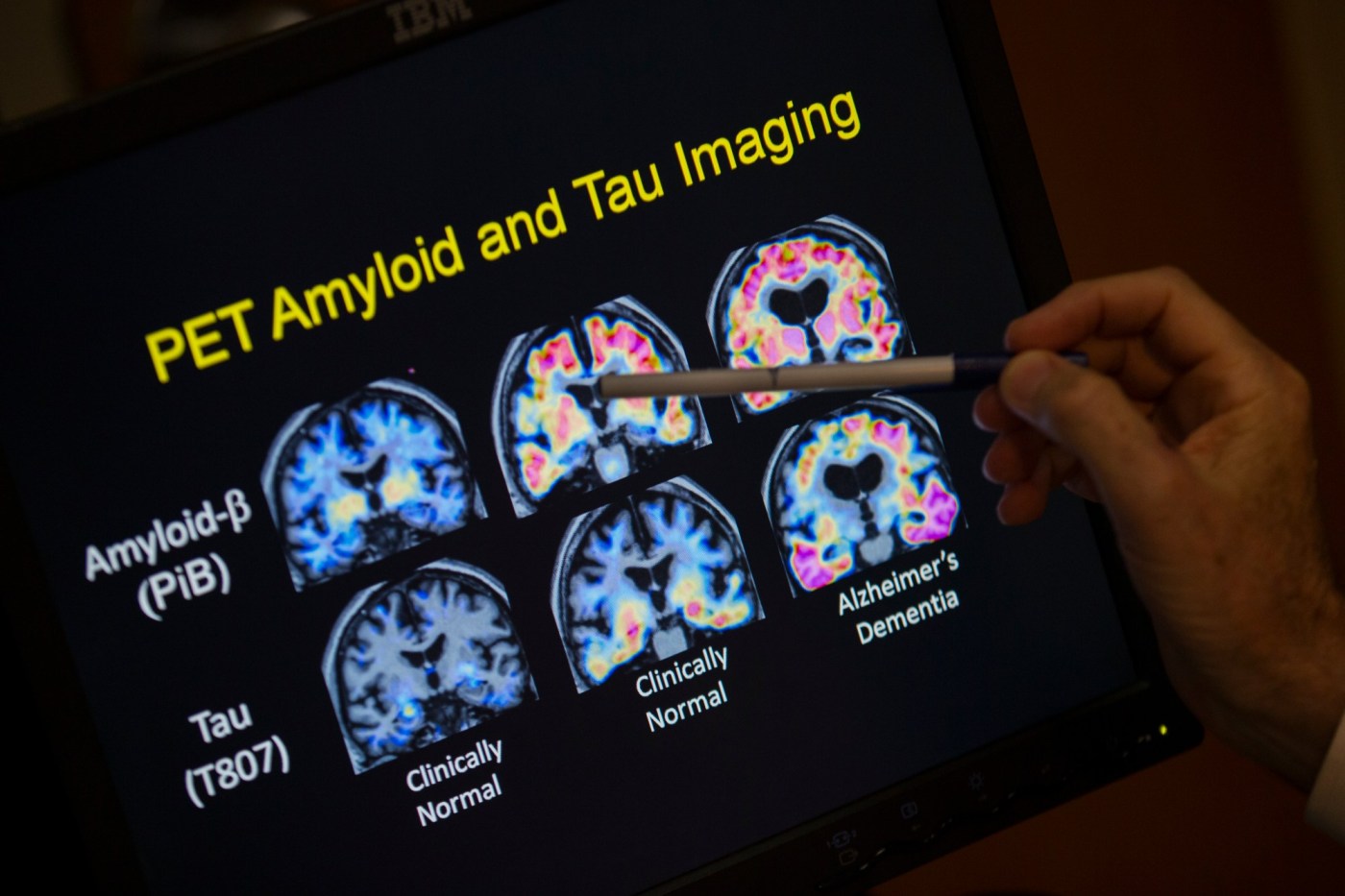 Alzheimer’s disease study: researchers create at-home smell test for early detection