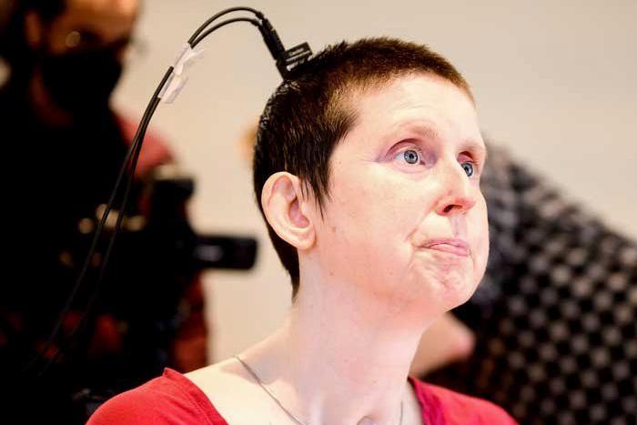 A stroke survivor speaks again with the help of an experimental brain-computer implant